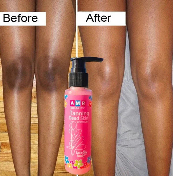 Dead Skin & Tan Remover for Smooth, Radiant Skin (Buy 1 Get 1 Free)