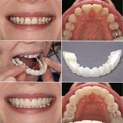 ADJUSTABLE SNAP-ON DENTURES