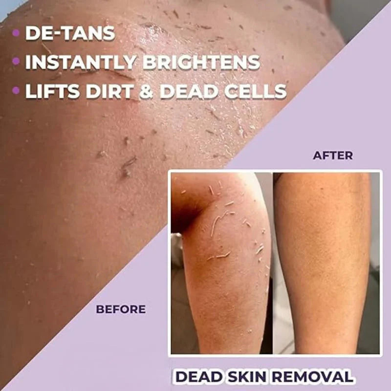 Dead Skin & Tan Remover for Smooth, Radiant Skin (Buy 1 Get 1 Free)