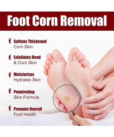 Feet Corn Removal