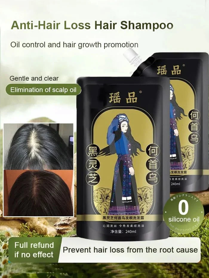 Ginger Plant Extract Anti-Hair Loss Hair Shampoo (BUY 1 GET 2 FREE)