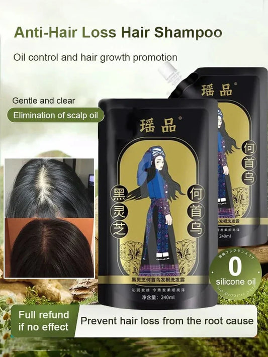 Ginger Plant Extract Anti-Hair Loss Hair Shampoo (BUY 1 GET 2 FREE)