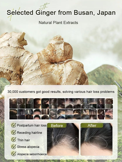 Ginger Plant Extract Anti-Hair Loss Hair Shampoo (BUY 1 GET 2 FREE)